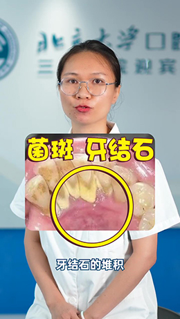 一刷牙就出血？別慌，看看醫(yī)生怎么說